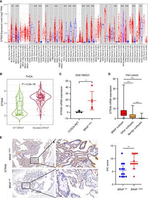 STRA6 regulates tumor immune microenvironment and is a prognostic marker in BRAF-mutant papillary thyroid carcinoma